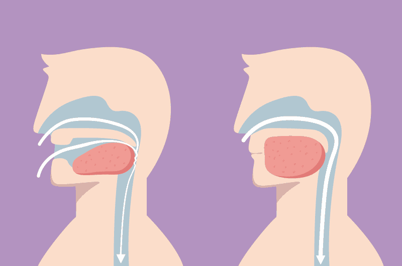 Open or close mouth changes the position of the tongue. When your mouth is open, your tongue falls backward and obsruct the airway and leads to the snoring sound.